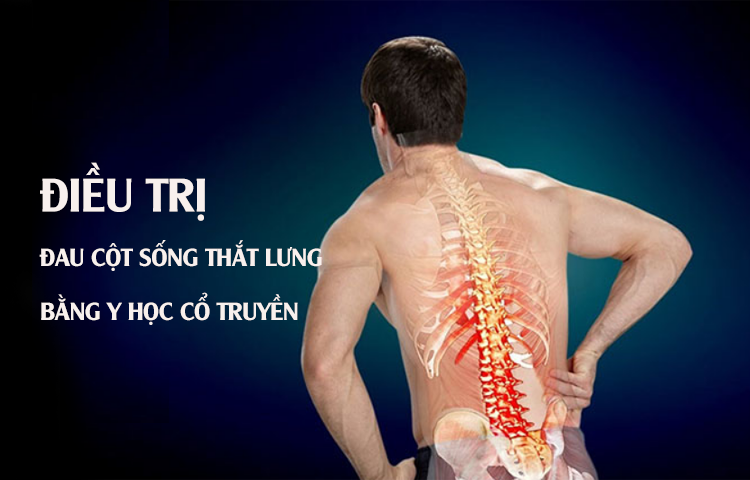 Điều trị đau cột sống thắt lưng (Yêu thống) bằng y học cổ truyền